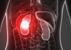 Cara Meningkatkan Fungsi Ginjal: Pendekatan Ilmiah dan Tradisional