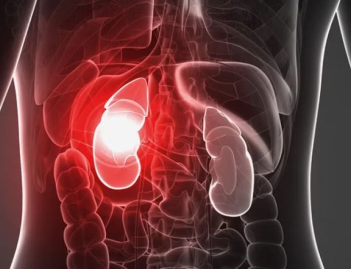 Cara Meningkatkan Fungsi Ginjal: Pendekatan Ilmiah dan Tradisional