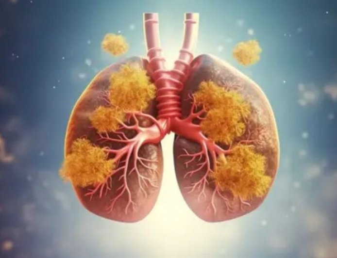 Pencegahan Penyakit Paru-paru